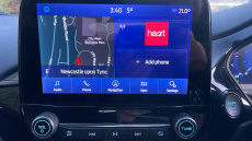 Ford Fiesta 1.0 EcoBoost Titanium X 5dr Petrol Hatchback